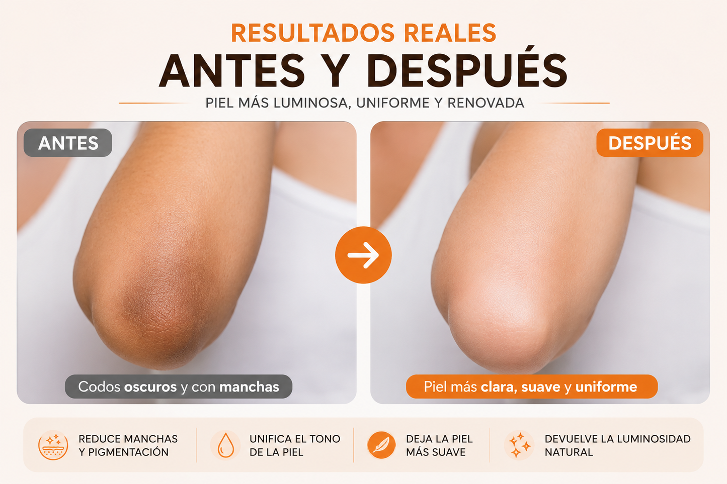 ✨ Despídete de las Zonas Oscuras y Devuélvele el Brillo a Tu Piel - Envío gratis y pago contra Entrega 📦